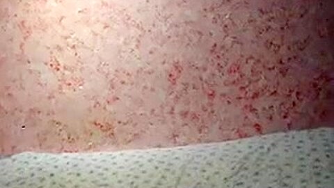 ANAL FISTING AND BIZZARE INSERTIONS