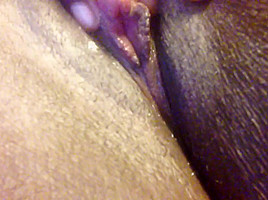 Big clit
