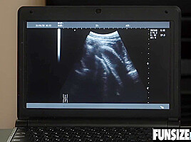 Boy Twink Gets Anal Ultrasound With Doctors Giant-sized Dick Deep In