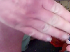 Egg and spoon foreskin - 1 of 3