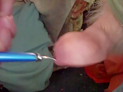 Egg and spoon foreskin - 1 of 3
