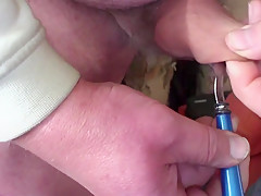 Egg and spoon foreskin - 1 of 3