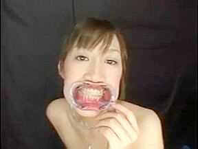 Japanese girl with braces and cheek retractors
