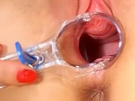 Lara Stretches Her Pussy With A Speculum For An Examination