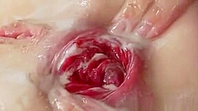 Nasty Enema Fetish Sluts Fisting Ass