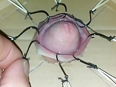 cbt extreme fishhooks torture 1